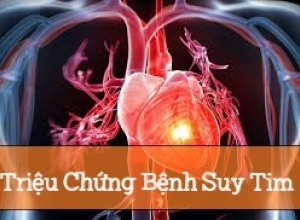 Nhận Biết Sớm Những Triệu Chứng Của Bệnh Suy Tim Để Phòng Ngừa